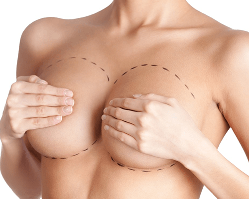 breast surgery