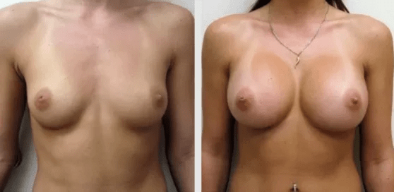 --Choosing Your Plastic Surgeon