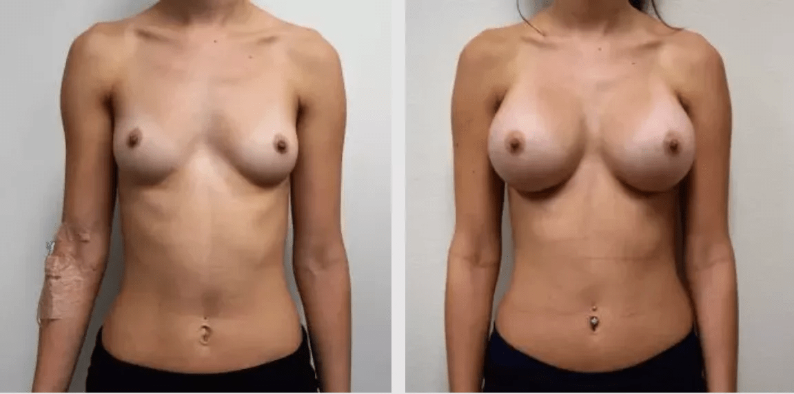 --Choosing Your Plastic Surgeon