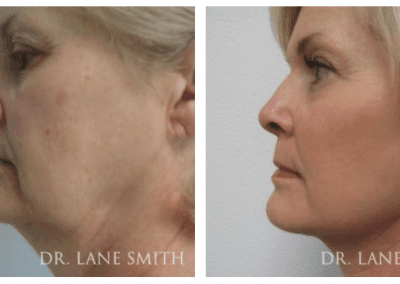 A side view of a woman's face.
