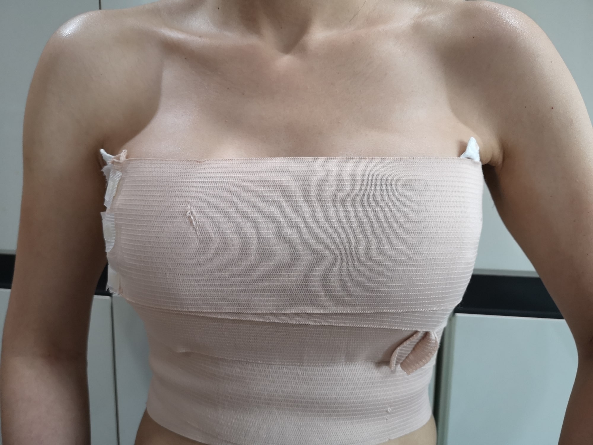 Breast Augmentation Surgery