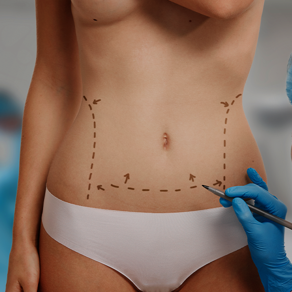 A woman is having surgery on her stomach. A woman is having surgery on her stomach.