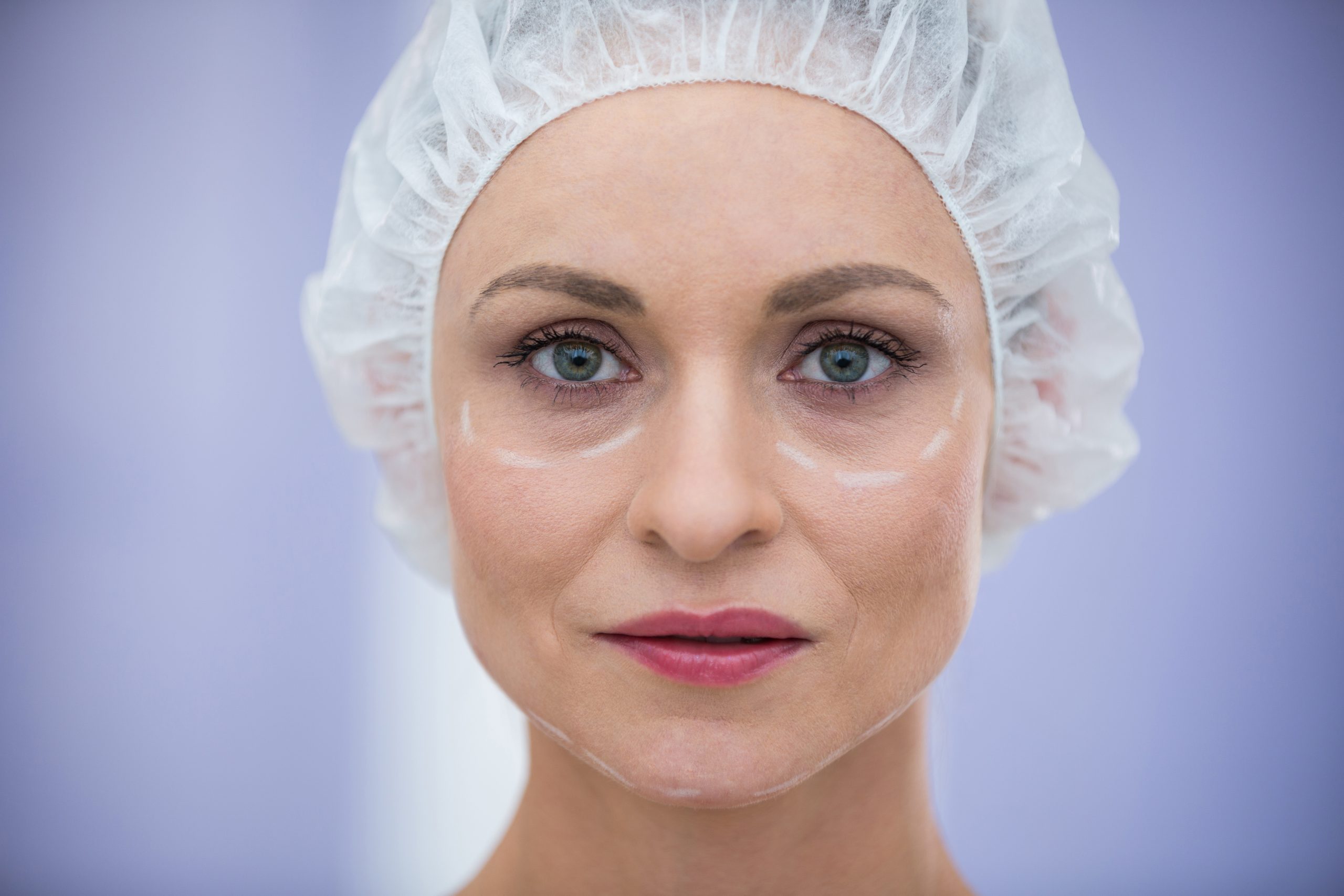 Ear Reshaping Las Vegas Nevada Smith Surgery