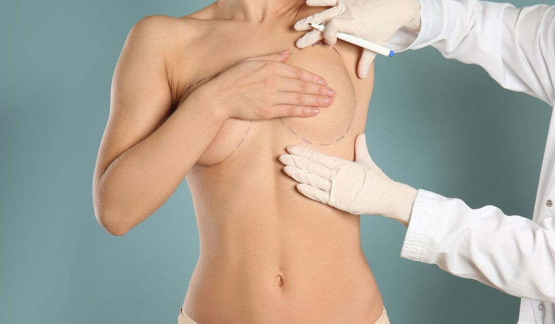A person is undergoing a pre-surgery consultation for breast augmentation, with a doctor's gloved hands marking lines on their chest.