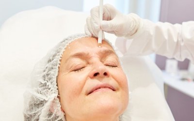 Mini Facelift vs. Full Facelift: Which Is Right for You?