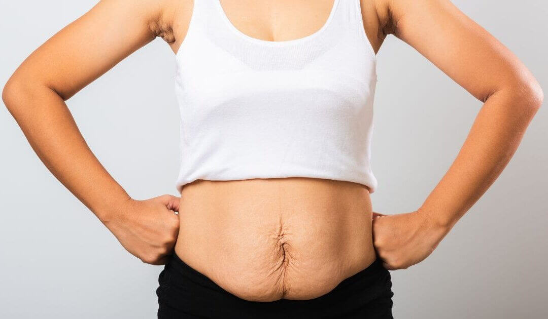 Top 4 Affordable Tummy Tuck Options in Las Vegas: Your Guide to Quality and Value