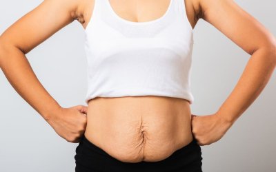 Top 4 Affordable Tummy Tuck Options in Las Vegas: Your Guide to Quality and Value