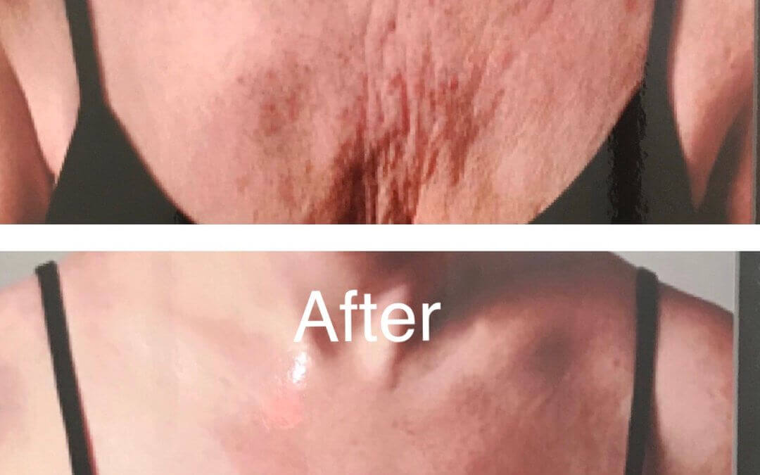 Best Cosmetic Surgery in Las Vegas for Natural-Looking Results