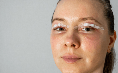 Blog 4 Eyelid Lift Cosmetic Surgery: How Blepharoplasty Can Refresh Your Appearance