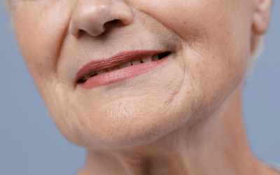 Blog 3 Face Lift Surgery in Las Vegas: When Is the Right Time to Consider It?