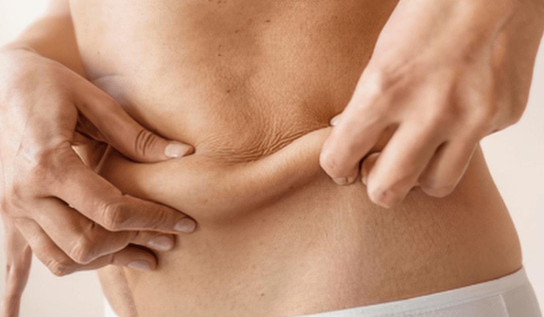 Tummy Tuck Recovery: What Patients in Las Vegas Should Expect Week by Week