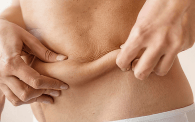 Blog 2 Tummy Tuck Recovery: What Patients in Las Vegas Should Expect Week by Week