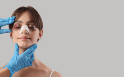 How Much Is a Nose Job in Las Vegas? Factors That Influence Rhinoplasty Cost