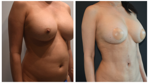 BeforeAfter-1430 34