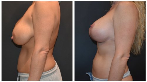 Case1458- Case1458- 34