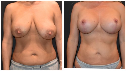 Case1458- Case1458- Center