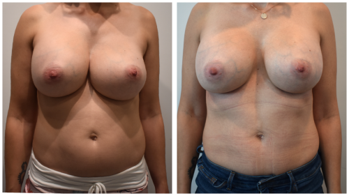 Reduction-before-after Center